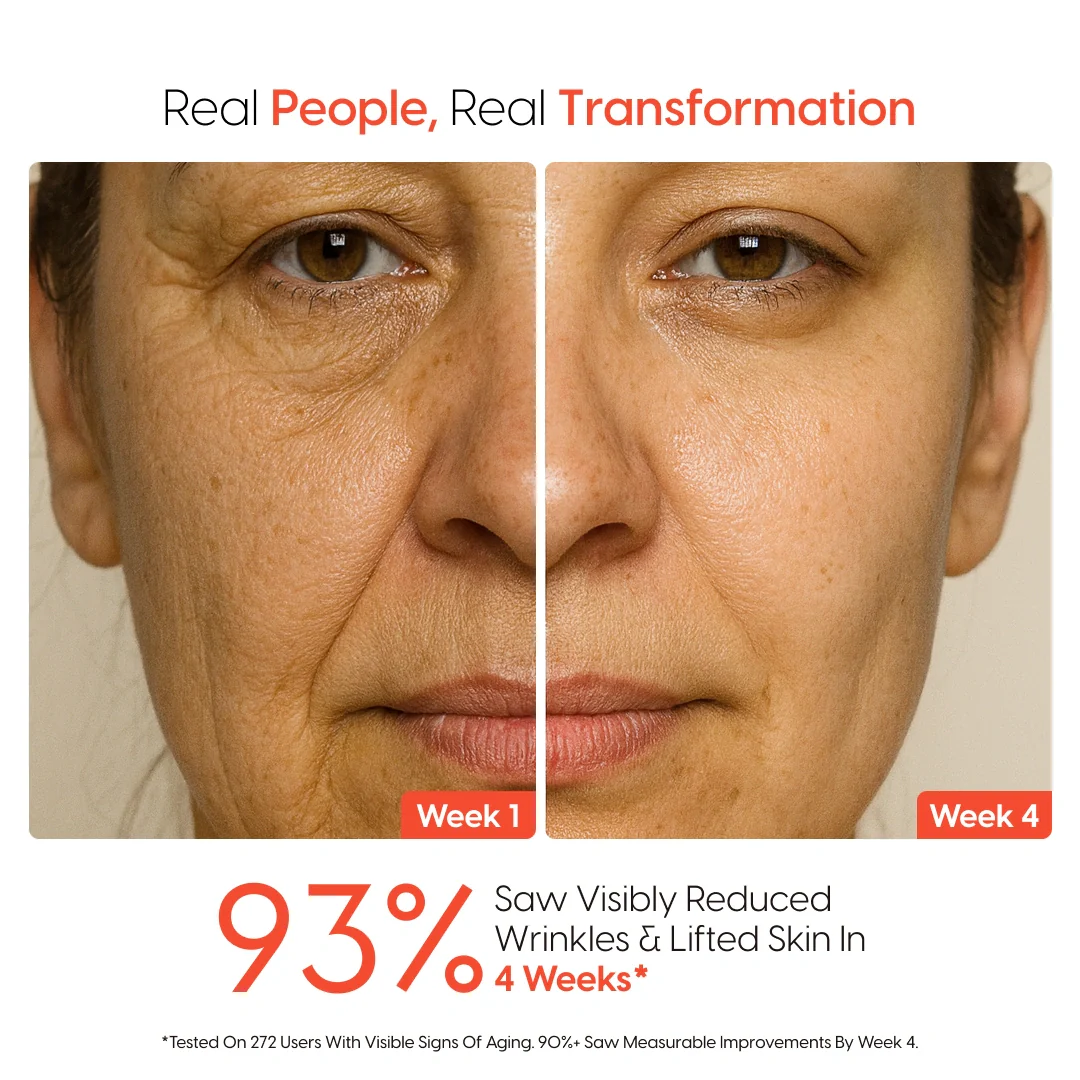 4-Week Age Reversal Treatment - Image 6