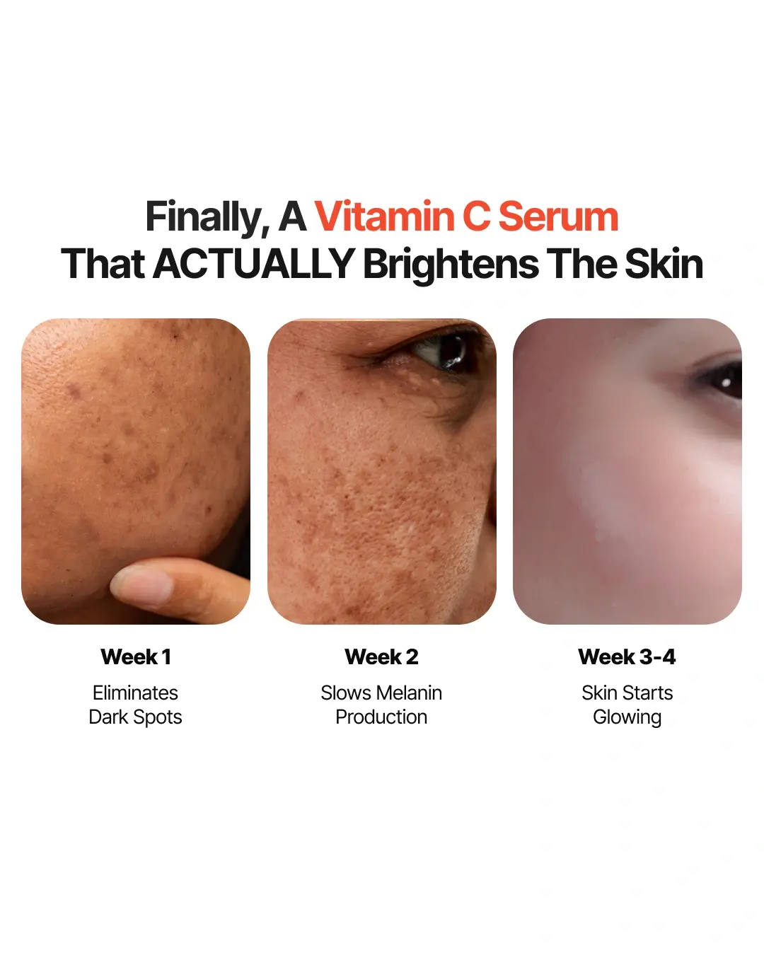 4-Week Hyperpigmentation Treatment - Image 4