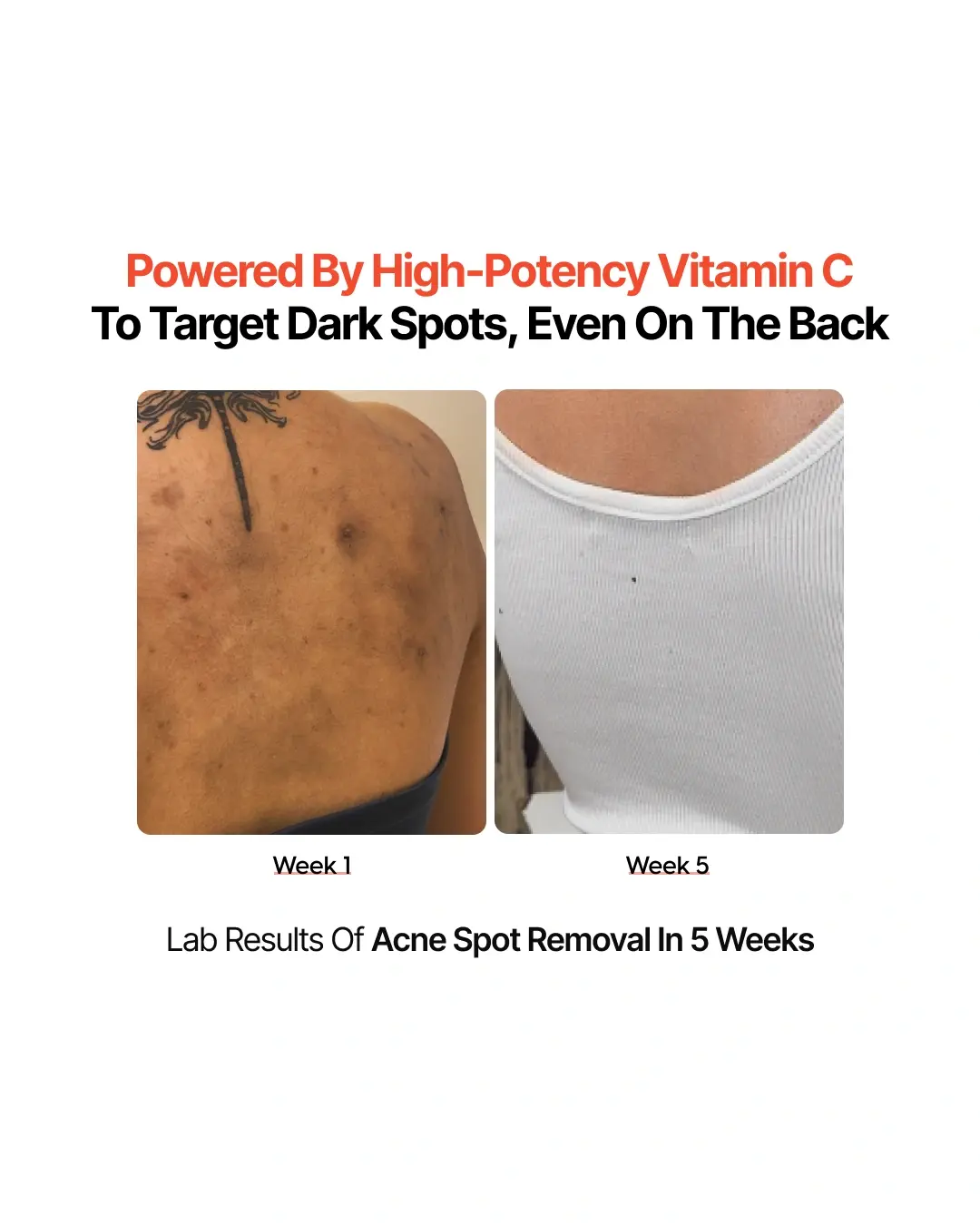 4-Week Hyperpigmentation Treatment - Image 5