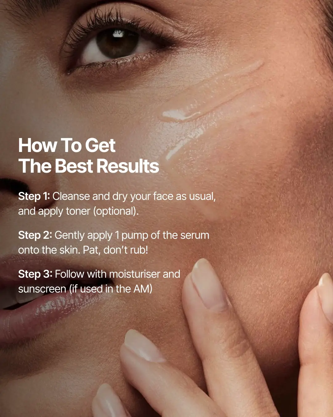4-Week Hyperpigmentation Treatment - Image 8