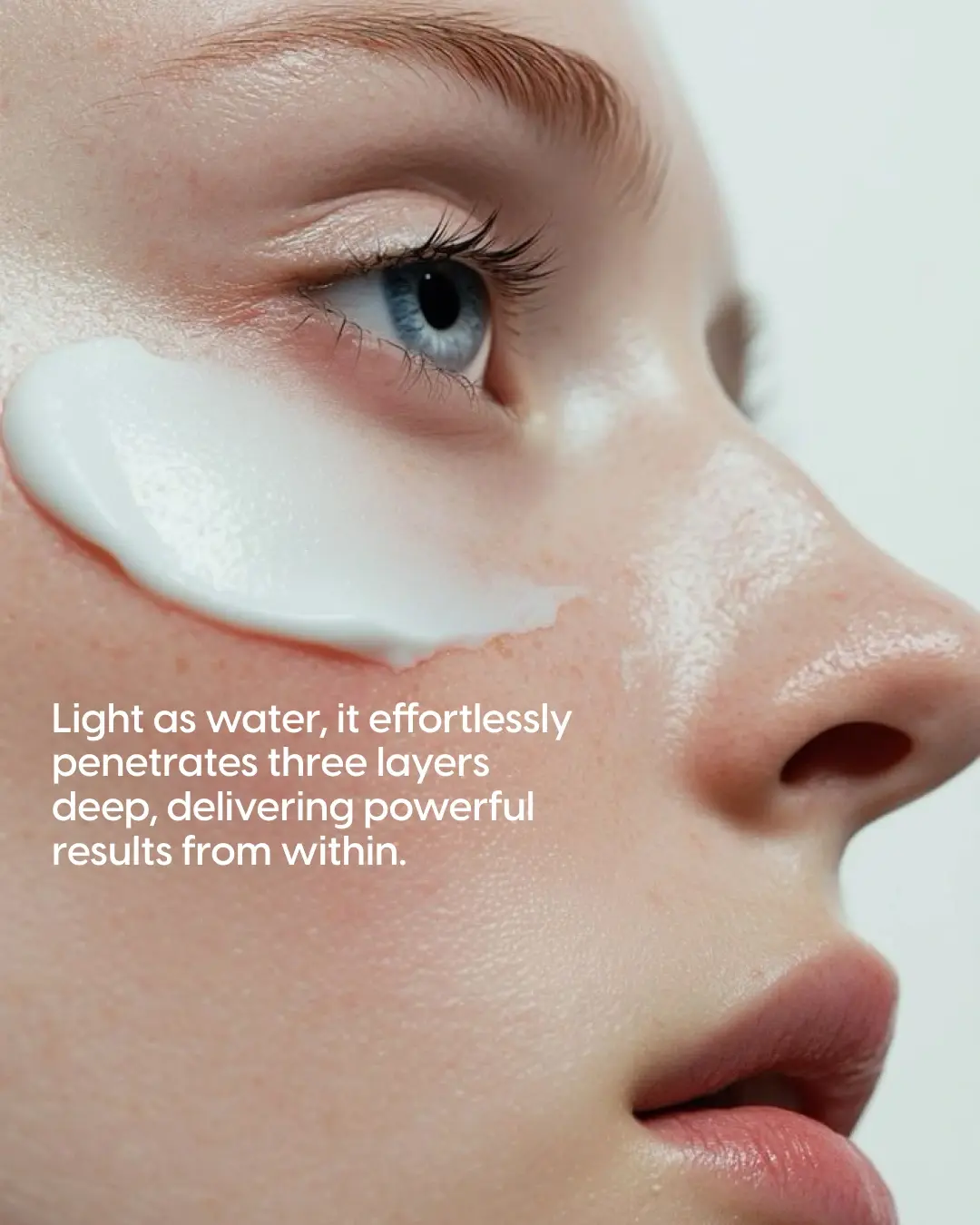 14% Pure Azelaic Acid Serum The Only Ingredient That Truly Ends Acne - Image 5