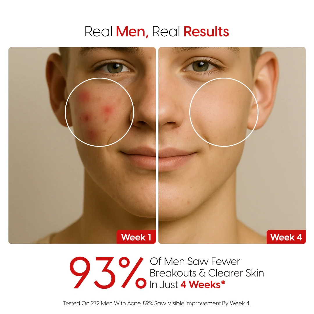 8% Pure Azelaic Acid Serum Ends Post-Shave Acne For Good - Image 6