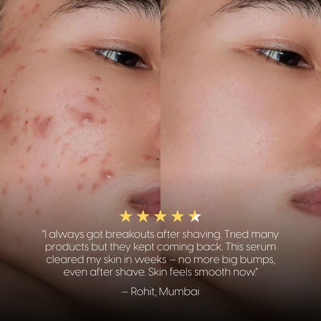 8% Pure Azelaic Acid Serum Ends Post-Shave Acne For Good - Image 8